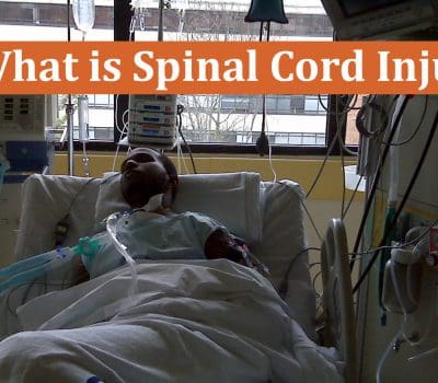 This Is One Of The Most Devastating Injuries